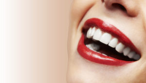 Six month smiles treatment-smiling - perfect set of teeth