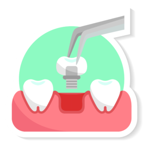singel teeth implants in manchester