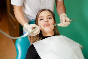 Dental Cleaning and Polishing