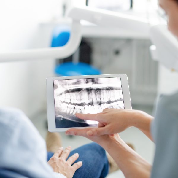 Dentist and man looking at scan of teeth in oral surgery room