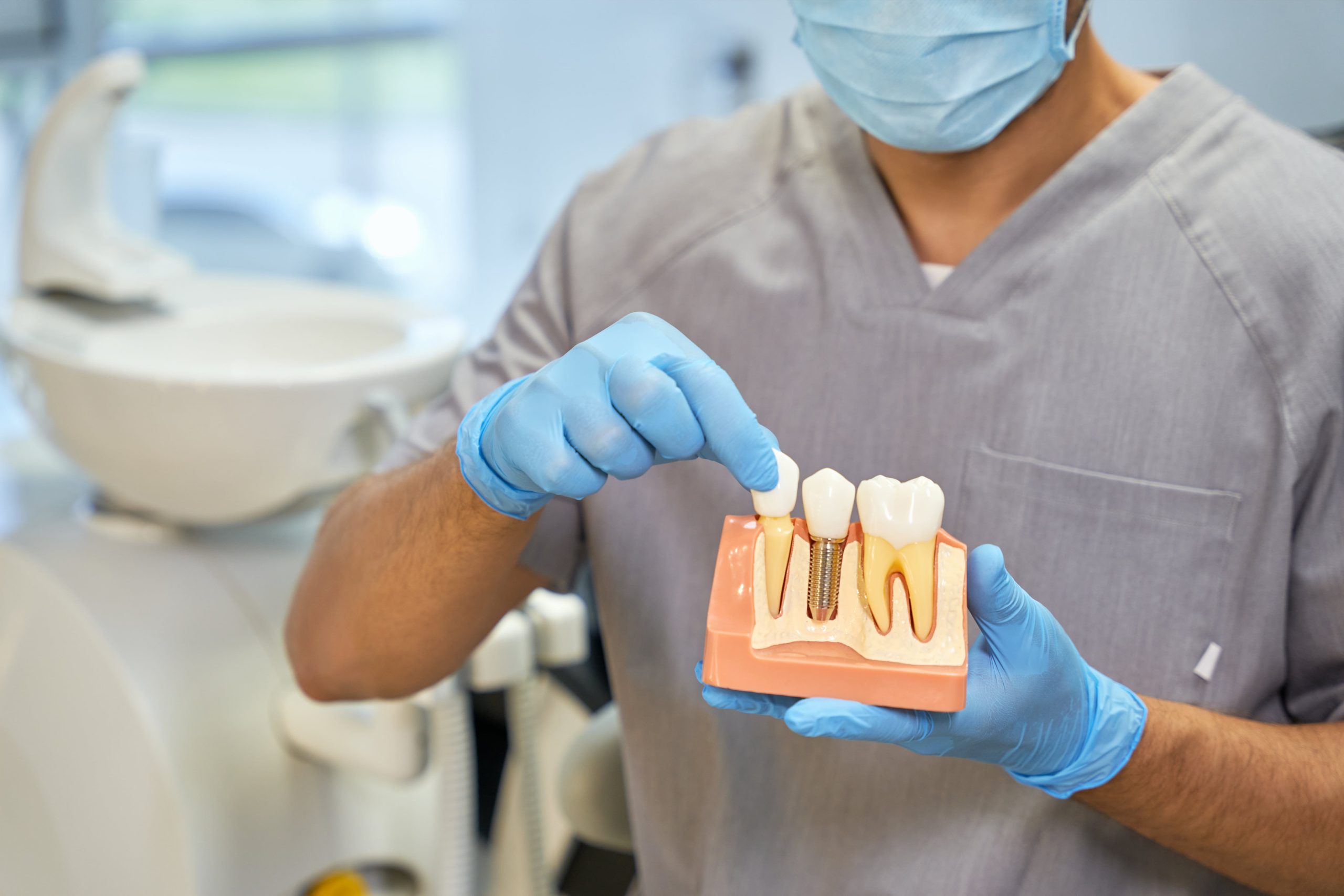man showing 3d model of dental implants next to healthy teeth