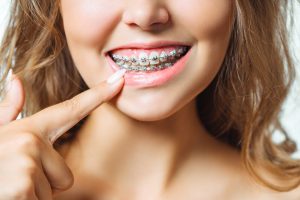 orthodontics treatment