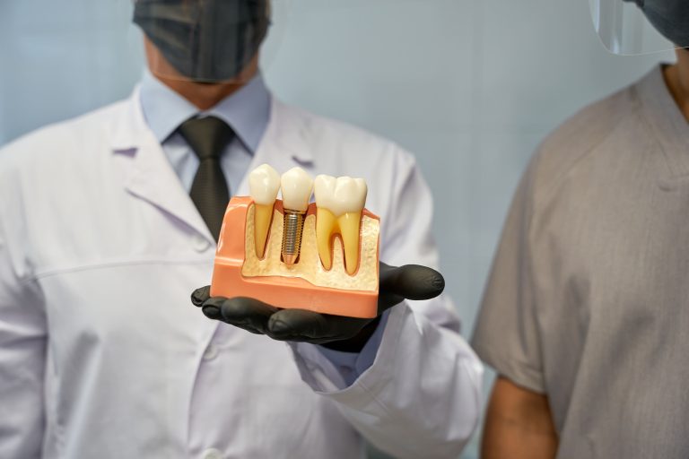 Homepage 8 Dental Implants for Older Patients
